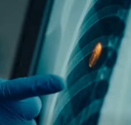 Il mio nuovo medico ha esaminato i miei esami e ha detto: “Tuo genero ti ha curato? Quello non dovrebbe esserci”… Mi sono bloccato